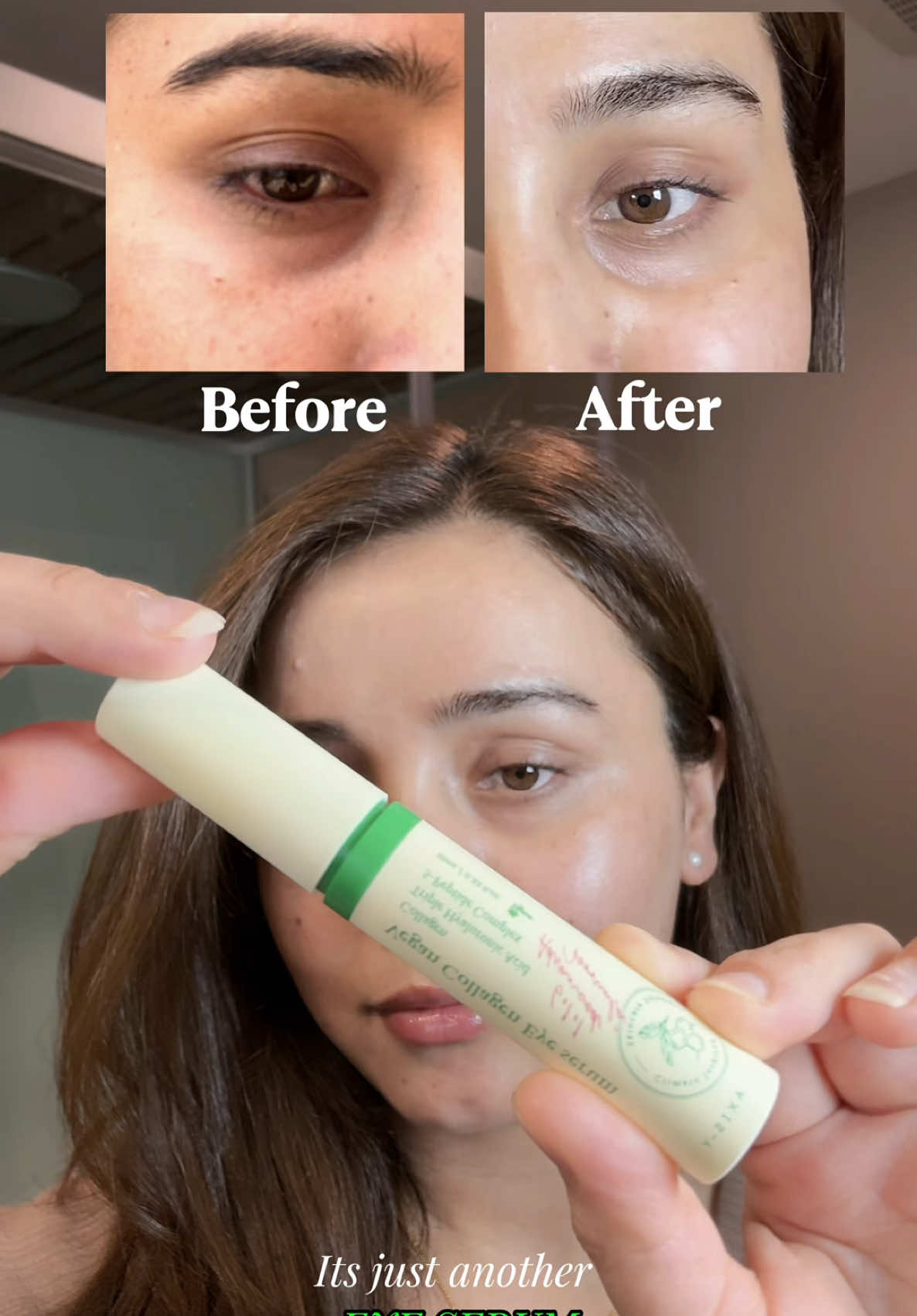 This eye serum has Collagen, rich in peptides and deeply hydrates!! 💦✨ And their applicator is just what I need 💚  “AXIS-Y Vegan Collagen Eye Serum” @AXIS-Y  #fyp #anupras #collagen #eyeserum #eyeyoga #kbeauty #kbeautyskincare #axisy #axisyeyeserum #wrinkles #fineline #darkcircles #eyecare #koreanskincare 