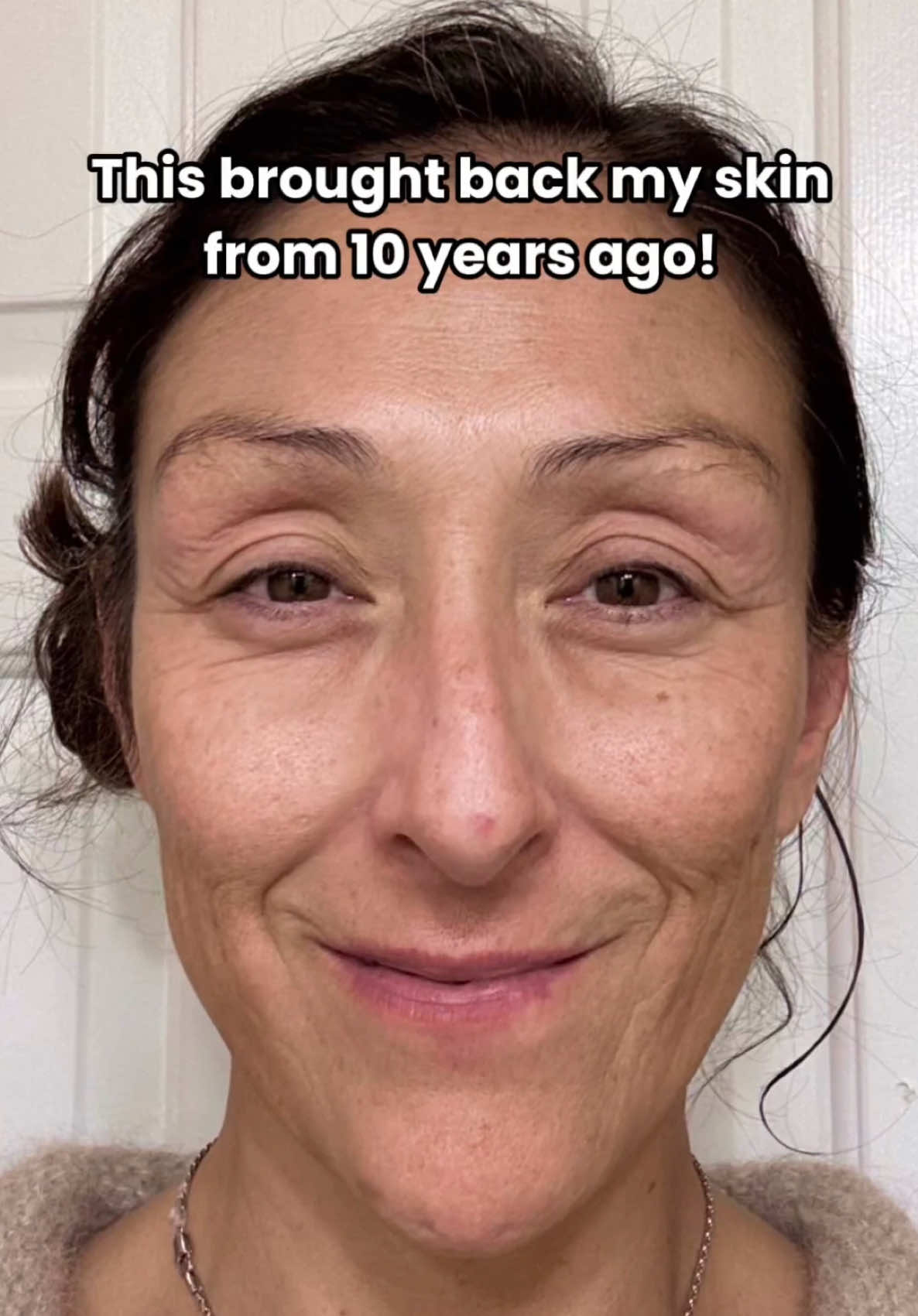 “Absolutely nothing else came close to removing the citrus fruit-like texture on my chin. This product brought me back to my perfect skin 10 years ago. Love this product! Cheers!” -Tanya S.  Meet The Cell Repair Serum, a prescription treatment with Nobel Prize-winning exosome technology to combat aging at the cellular level! 🧬 Get started at Musely.com!