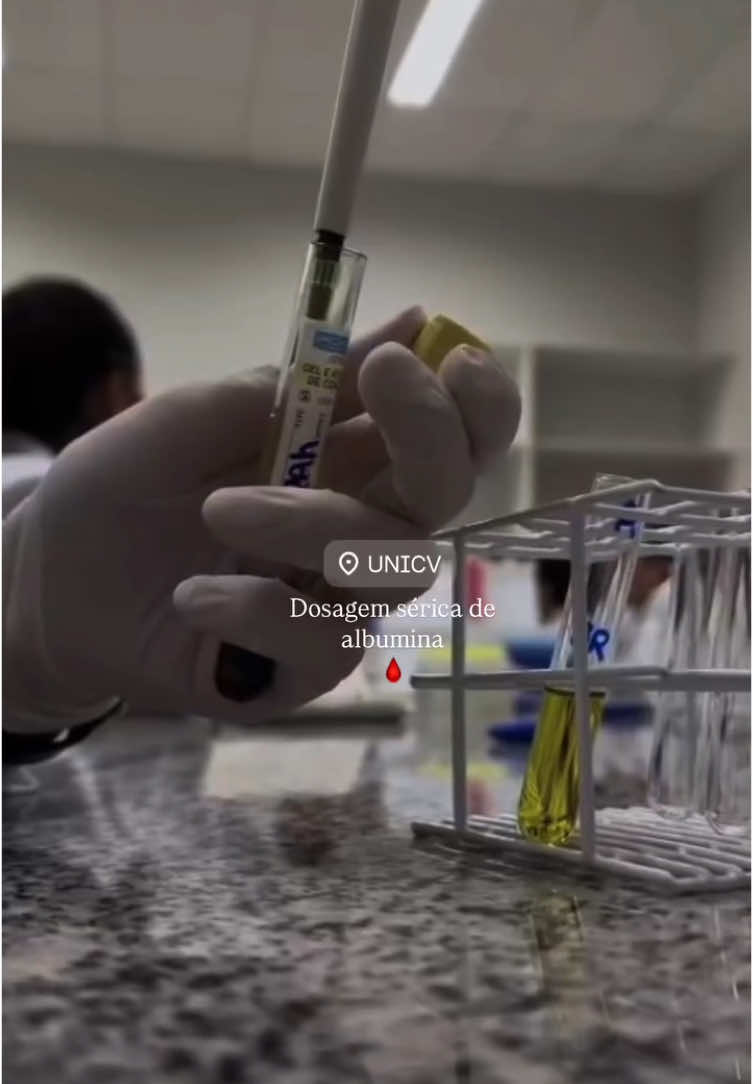 #biomedicina #análisesclínicas #albumina 