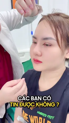 Mí Phượng hoàng - A tuyền 3tr #xuhuong #LearnOnTikTok #nangmui #nangmuisline #nangmuiphongthuy #nangmuicautruc 