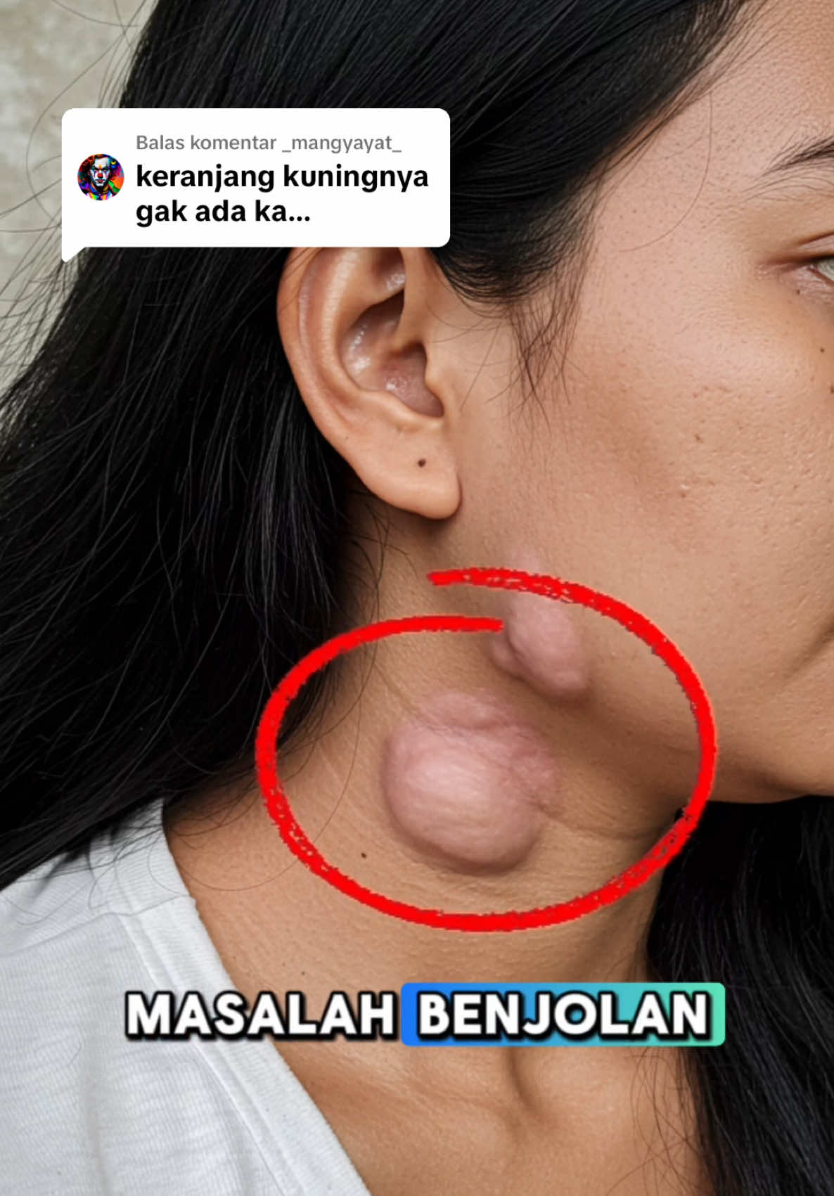 Membalas @_mangyayat_ disini kak buruan sebelum kehabisan #lipomacream #saleplipoma #lipoma 