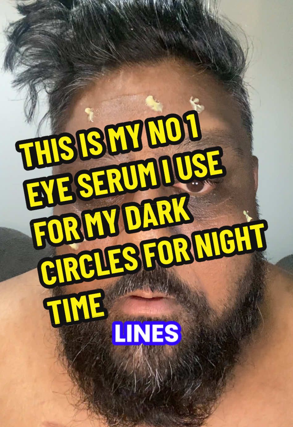 Replying to @al-hamdan #hyperpigmentation #darkspots #darkcircles #tiredskin #wrinkles #finelines #retinal #sleepapnea #koreanskincare 