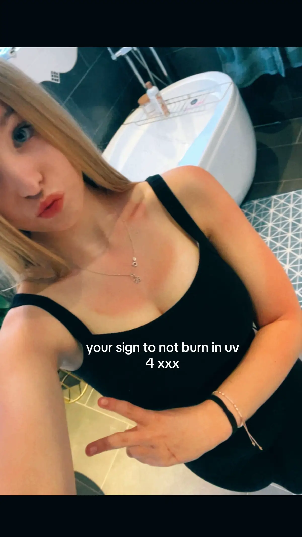 oops🤷‍♀️ (it’s not too bad) #ukweather #uv #burnt #sun 