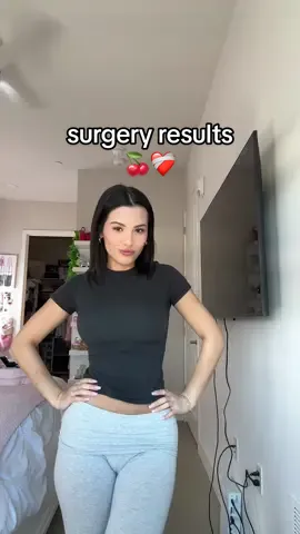 2 weeks since 🍒 surgery! Still in the healing process. Swollen & need to drop. They’ll be mostly healed end of June :) #breastaugmentation #boobjobreveal 