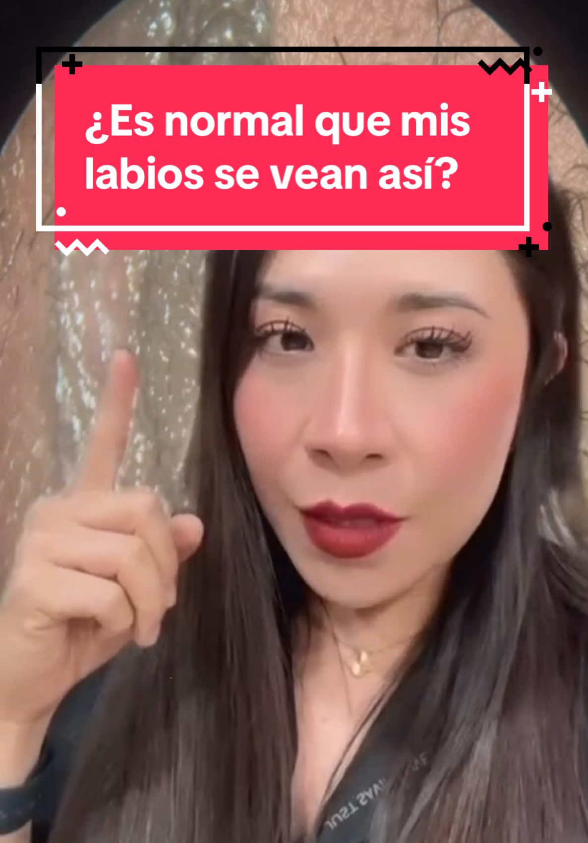 ¿Que mis 👄 menores se vean así, es normal? 🤔 ¿O significa que tengo VPH o alguna ITS? 😨 Muchísimas pacientes vienen a consulta creyendo que tienen alguna ITS porque su parte g3nit4l luce así… ¿Es normal o no? ¡Te cuento en el video! 🙌🏼 Dra. Verónica Noemí Reyes Santillán  CP: 10900734 Universidad Autónoma de Nuevo León  #ginecologa #ginecologiaeobstetricia #AprendeEnTikTok #locuentoentiktok #ginecologia #vph 