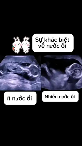 Các Mẹ bầu thấy có đúng không ạ?? #HOIBABAU #tiktok #trend #xuhuong #embena🐍2025 #embena #hottrend #thinhhanh #top #baubi #HỘI_BÀ_BẦU_ngũ_cốc_lạc_lạc #ngucocbaulaclacplus #ngucocbaulaclacchinhhang #ngucocdanhchomebau #mangthai #thaidoi #sinhdoi #embena🐍 #ngũ_cốc_bầu 