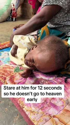 #fypシ゚ #sorotan #changelifewithmathew #babiesoftiktok 