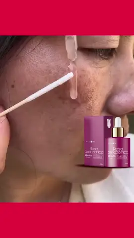 Estou simplesmente apaixonada pelos resultados e tenho certeza de que você também vai amar💖 🔗 Link na minha bio, corre lá e aproveita que restam poucas unidades ❌ #hialuronico #produtosdebeleza #peleperfeita #pelesaudavel #skincare