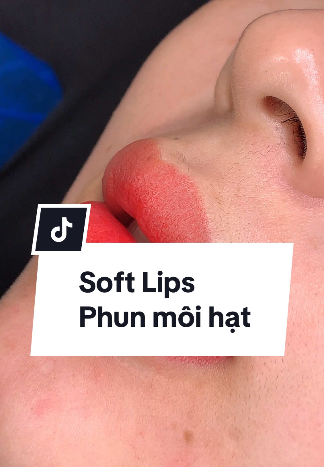 Phun môi hạt với em đi quý zị ơi❤️ #phunmoi #khumoitham #moihat #softlips 
