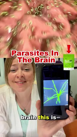 parasites in the Brain #worm #detox #tiktokshop #health #supplements #detoxify #bacteria #healing 