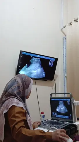 Sehat truss utunn💖 @jung_jjamal #usg4d #usg #4bulan #masyaallahtabarakkallah #pregnant #beby #grilsorboys #fyppppppppppppppp #xybca  #fyppppppppppppppp #4upageシ 
