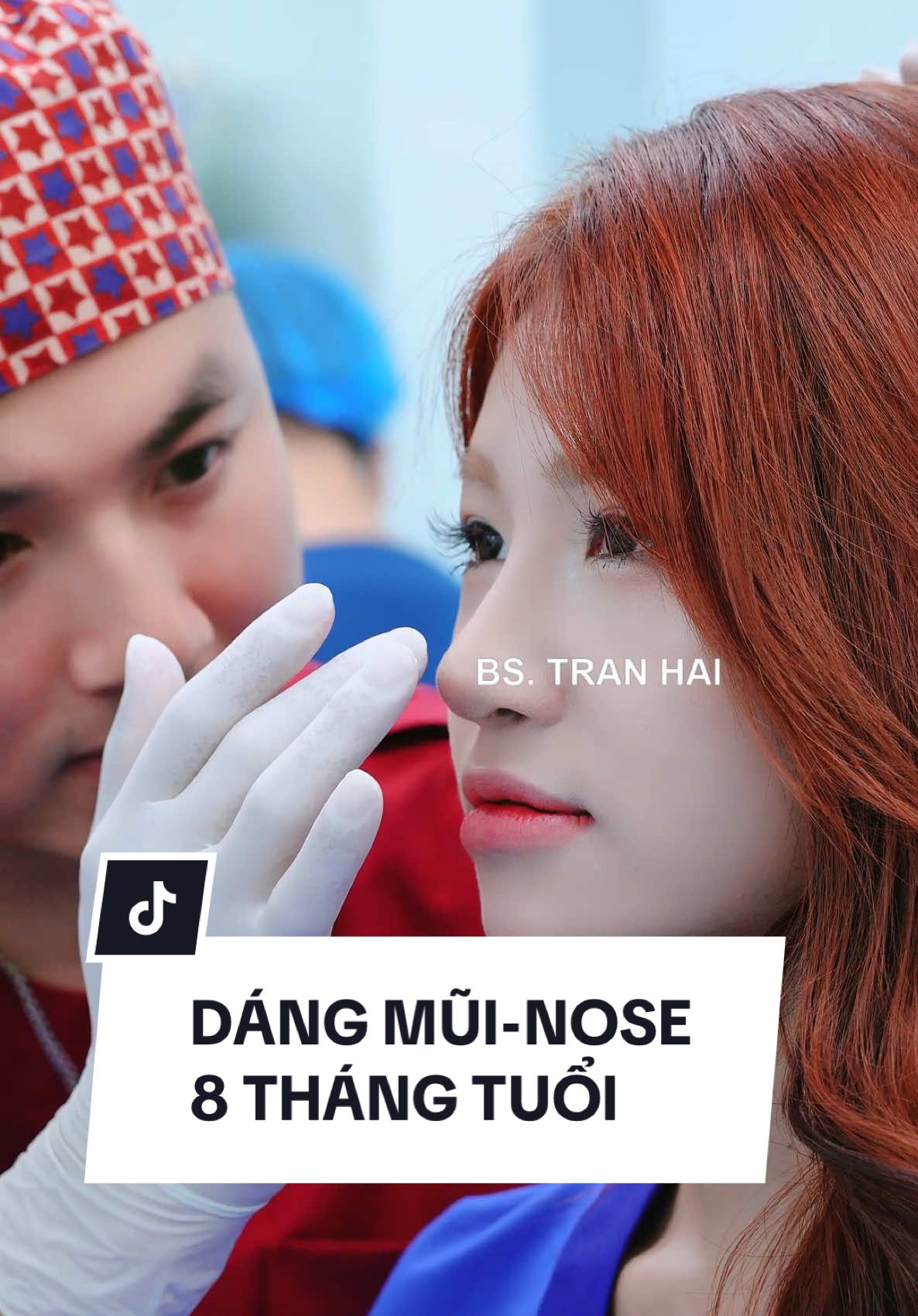 DÁNG MŨI-NOSE 8 THÁNG TUỔI #nangmuisline #nangmuiantoan #nangmuisuntai #nangmuiphongthuy68 #nangmuiphongthuy #dangmui #dangmuiphongthuy #nangmuicautruc #xuhuong #xuhuongtiktok #nose 