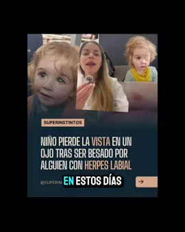 Un niño perdió la visión luego de que le dieron un beso en el ojo. Te cuento todo lo que tenés que conocer acerca de los herpes virus 🦠  . . . #drapascali #skincare #cuidadodepiel #virusherpes #cuidadoconlosojos #herpeslabial 