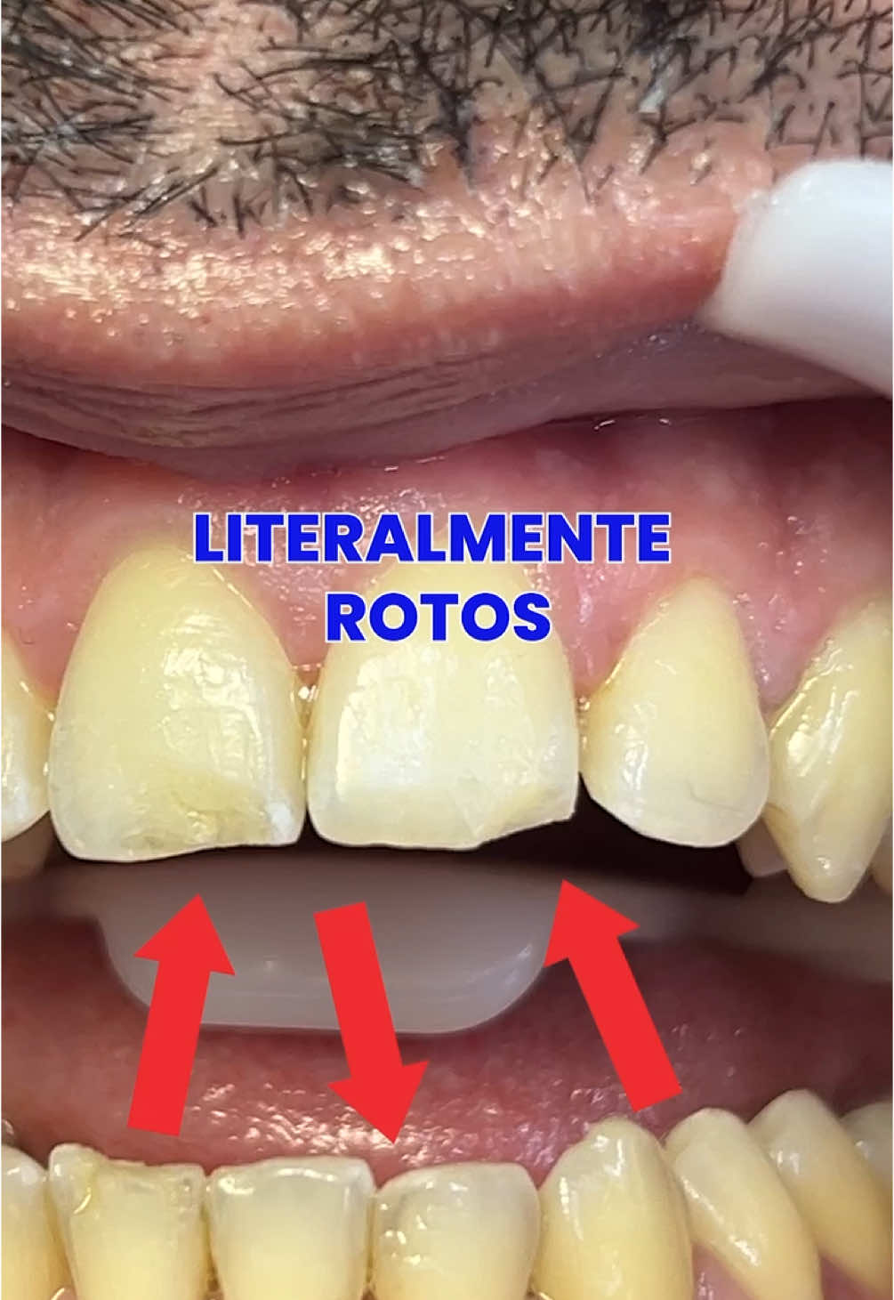 Mis dientes de perro callejero csm #furrey #todogood #hablagood gracias a Odontopando y a Esteban por salvar mi boca
