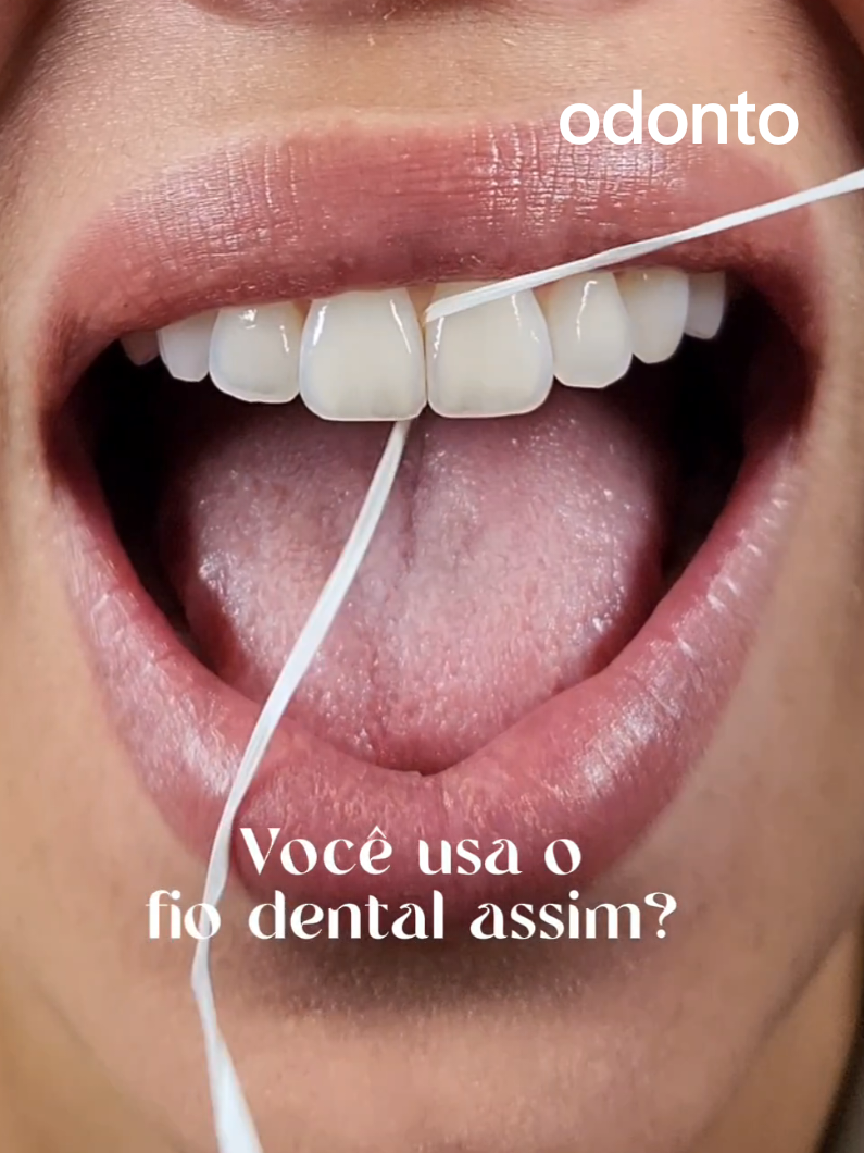 🍃 Passar o fio dental da forma correta faz toda a diferença para a saúde da sua gengiva. 🧵 Deslize o fio suavemente entre os dentes, abraçando cada um em formato de “C” e levando o fio até a linha da gengiva. 💡 Dica extra: Use uma parte limpa do fio para cada espaço. 🫂 Esse cuidado simples previne cáries, mau hálito e inflamações gengivais. Não pule essa etapa! #dicasdesaude #dicas #fyp #dentistarj #fiodental #foryoupage 