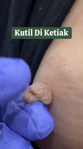 ada yang punyaaa ???? di bagian mana nii 🫢 -ra