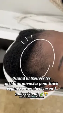 Part. 89 | Un problème de cheveu ? Une solution rapide pour la repousse de cheveux 🙌🏾 #creatorsearchinsights #chutedecheveux #hairgrowth #poussecheveuxrapide #poussedecheveux #pourtoi #fyp #alopecie #cheveuxcrepus 