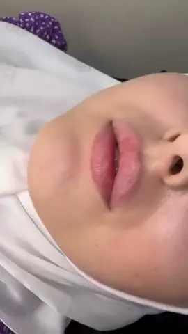 💋RELEVA LIPS 💋 ☎️043294666 📞0567033459 📍Dubai Jumeirah Al Wasl Road Umm Suqeim 2 Villa 1144 #عيادة_تجميل #تجميل_دبي #جلدية -دبي#عيادةاسنان #بوتوكس #فيلر #ليزر #عنايةبالبشرةوالشعر #عيادة_الأسنان #aesthetic #botoxfacial #russianlips #beauty #dentistry #clinica #trendingreels