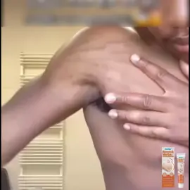 Crème Anti-Vergetures