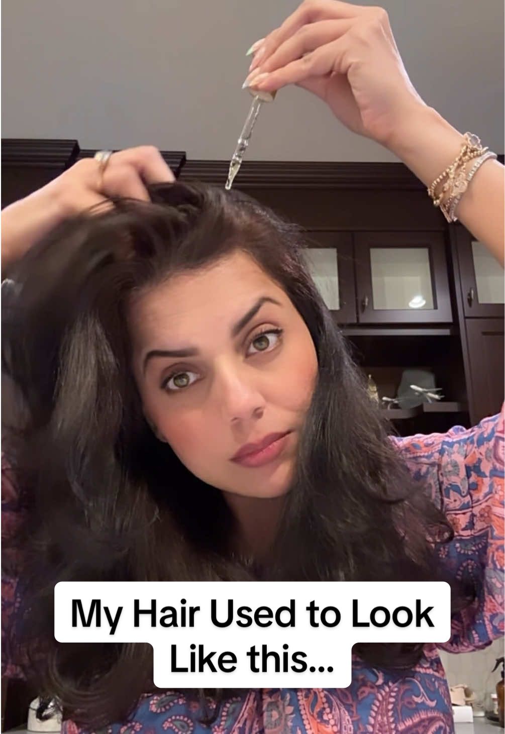 NO OTHER PRODUCT can touch the results I got from Amazing Hair Savior - get your hands on it and start YOUR JOURNEY! www.amazinghairsaviour.com Let's get growing🌿 Love, Amber💖                              #hairtok #hairloss #hairgrowth #regrowinghair #hairtransformation 