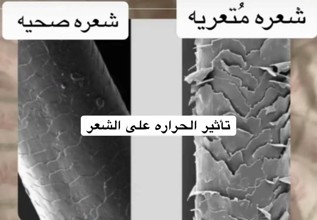 #عنايه_بالشعر_والبشره #عنايه_بالشعر #عنايه_بالبشره #الامارات_العربية_المتحده🇦🇪 #السعودية🇸🇦 #سودانيين_في_الامارات🇸🇩 #sudanese_tiktokمشاهير 