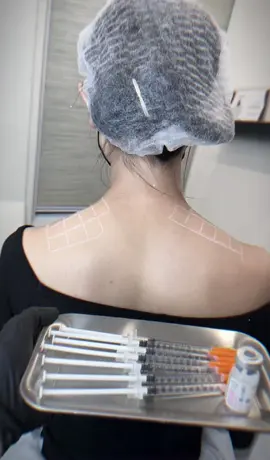Vai tròn – vai ngang – vai đô Botox thon gọn cầu vai “đánh tan” nét thô – giữ lại dáng sang mặc gì cũng xinh!#botox #traptox #filler #xuhuong #viraltiktok #ngoctrinh 