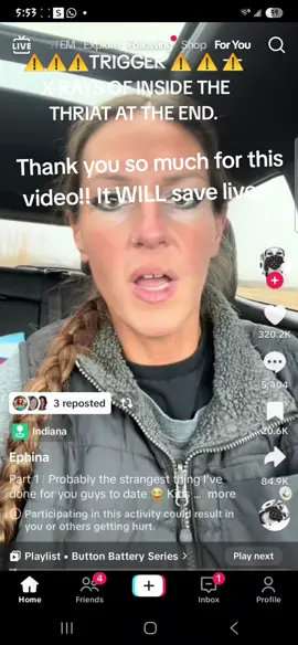 im greatful we caught it in time and we got him to the er. he could of died.  thank you to @Ephina for making this video!  #dangerous #becareful #batteryingestionawareness 