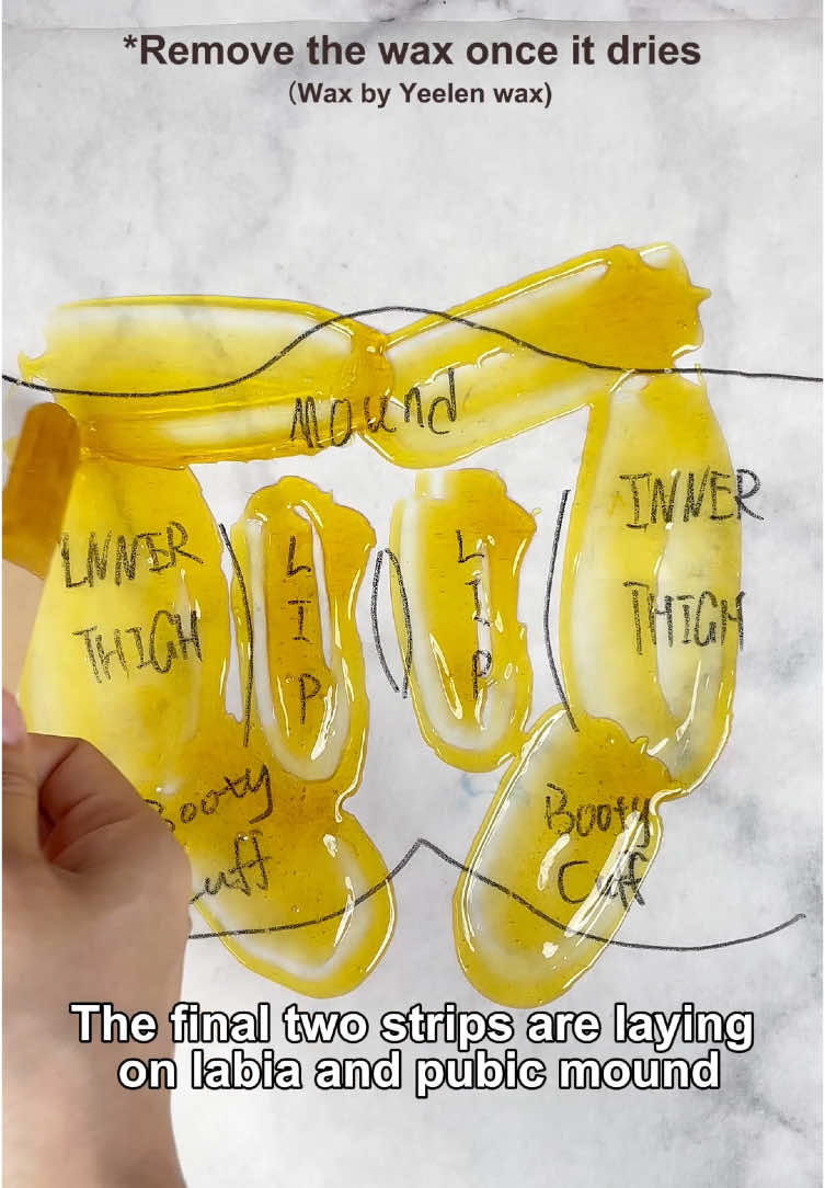 Check out Yeelen wax kit 😍 #yeelen #yeelenwax #yeelenwaxingkit #yeelenamazon #waxkit #hardwax #easywax  #waxingkit  #athomewaxing #waxingkit #wax #athomewaxingkit #waxingtips #waxing #selfwax #selfwaxing #selfwaxingkit #satisfyingvideo #satisfying #hairremoval #waxremoval #asmr#waxtips #howtowax #waxtutorial 
