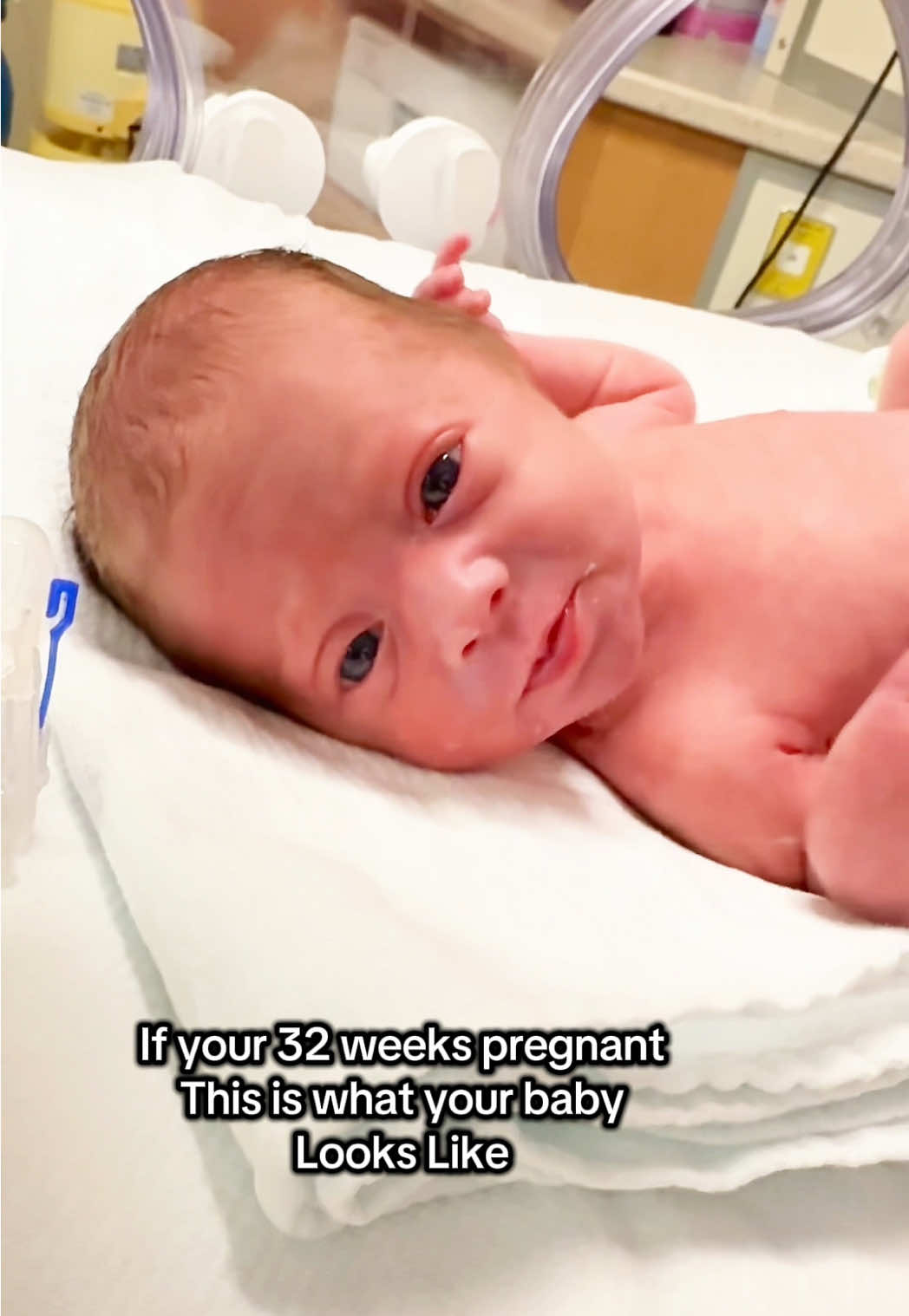 32 weeks.. our little fighter🎀 #nicu #nicubaby  #nicumom #32weekspregnant #32weeks #32weeker #32weekpreemie #pregnant #pregnanttiktok #pregnanttok #CapCut 