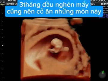 mẹ xem hết để biết top 5 món ăn này nhé #landaulamme #embechuarang #embe #baby #mebau #thainhi #xinvia #conyeu #mevabe #mebauthongthai #dinhduongmebau