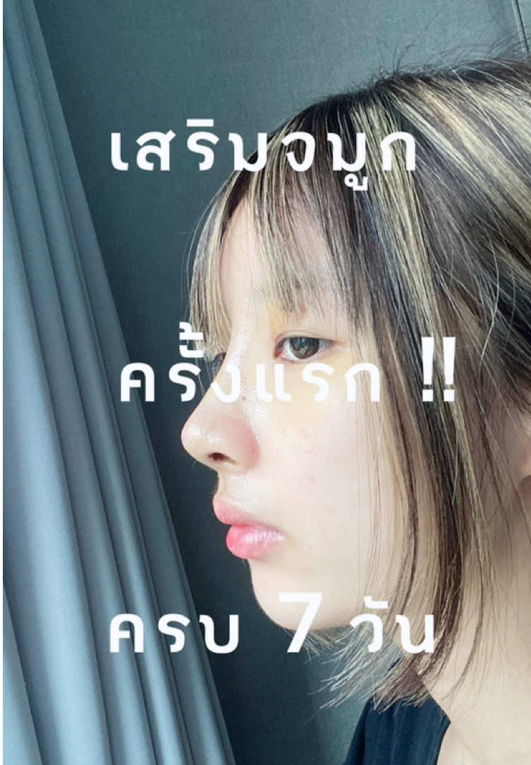 แค่ 7 วันก็สวยขนาดนี้เลยๆๆๆ🫠 #siriwellness #ศิริเวลเนส  #ลูกสาวหมอพัค #อยากละมุนต้องมุนอา #รีวิวเสริมจมูก 