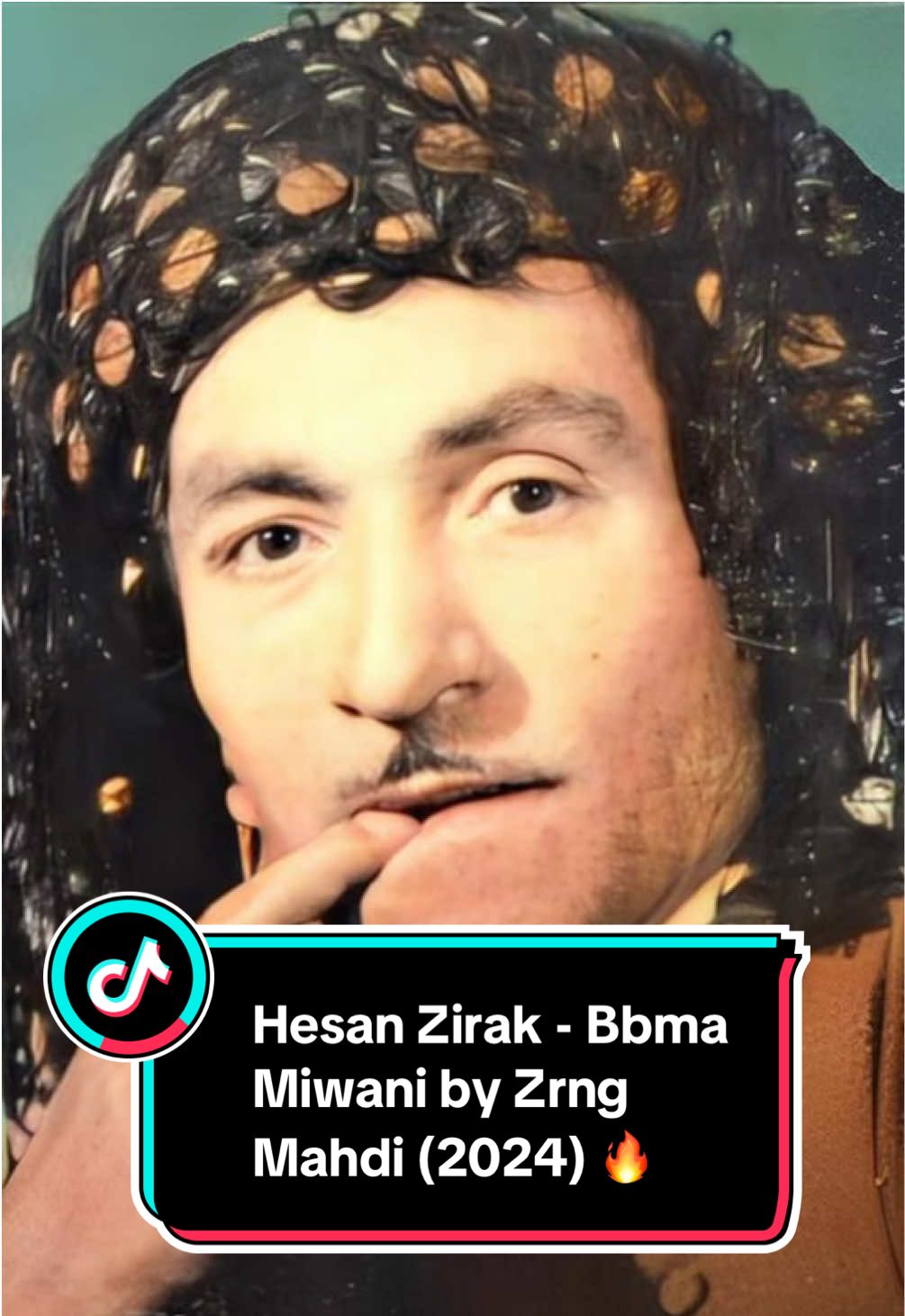 Hesan Zirak - Bbma Miwani by Zrng Mahdi (2024)  . . . . . . . . . . . . . . . . . . . . . . . . . . . . . . . . . . . . . . . . . . . . . . . . . . . . . . . . . . . . . . . . . . . . . . . . . . . . . . . . . . . . . . . . . . . . . . . . . . . . . . . . . . . . . . . . . . . . . . . . . . . . . . . . . . . . . . . . . #HesanZirak #ZrngMahdi #BbmaMiwani    #خانقينيهہ#nawroz2025 #Nowroz#nowroz2025 اغاني_كوردية# #Kurdistan2025 #ramazan2025ہ #slemane_hauler_karkuk_zaxo_kurdm  #SamiraKarzan #kurdsatmusic اهنگ# #slemany #goranihalparki #goranixosh2025 #goranixosh #HonyaKamal #AmDilayMn #Abdosman #Przha #goranikurd #hawler_slemani_dhok_karkuk_hallabja #kurdishplaylist #kurdmaxmusic #nocopyrightinfringementintended #2024 #topofthepops #ShabazZamani #kchijwan #Katana #arshosman #goraniHayatm #hayatm #kurdishgorani #NarimanBaban #aspon #kurdmusic #kUrdishmusic #kurdplaylist #Spotify #Shazam #tiktokmusic #sanabarznji #goranixosh #goranikurdi #karzanfaruq #JegrMedia #RozitaSangina #SamiraKarzan #BawanMurad #awkcha #kicha #kurdtiktok #mizkif #lifequote #ArshOsman #kurdishparty #classickurd #trend #sona #kurdishfood #qrt #kurdish #kurdi #kurdistan #kurd #kurdishcomedia #komidikurdi #komidya #komidia #kurdgirl #kUrdboy #kurdishgirl #kchakurd #kchkurd #livetitok #trend #viralvideo #viral #SUI #slemani #ebril #hawler #chamchamal #dohuk #kirkuk #funnykurdish #nrt2 #kurdishfunny #2024 #mrdm #funny #funnykurd #asia #kurdishmusic #DIYAKOZ #kurdishmusicvideo #kurdishplayer #ئەکتیڤبن🥀🖤ـہہـ٨ــہ  #top10 اكسبلور# #top2025music  #goranikurdi #هەولێر #kurdmax #اهنگ   