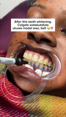 Your teeth shouldn’t match your maize. Let’s fix that smile for just Ksh 10,000. DMs open – your glow-up starts with a grin! 📍We're located in Nairobi, South B at Trance Towers, 8th floor, suite 801 📲 For Appointment Call: +254 112 485 103 #teethwhitening #stainedteeth #teethcleaning #yellowteeth #teethwhiteningnairobi #teethwhiteningkenya #teethwhiteninghack