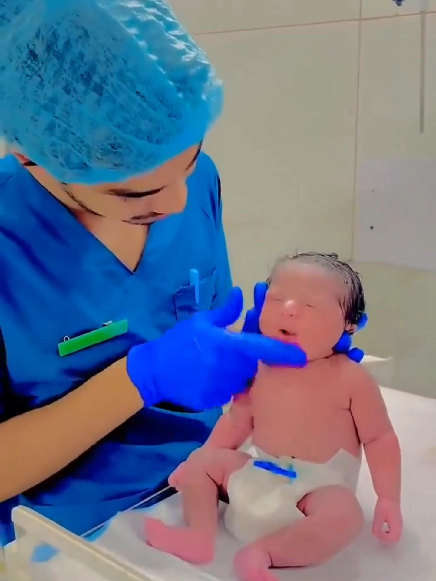 Moro Reflex Test: Essential for Assessing Newborn Neurological Health Doctors use the Moro reflex test to evaluate a baby's neurological function by observing their natural response to the sensation of falling, providing crucial insights into their developmental health. #doctor #moro#healthybhicoolbhi#healthyliving #baby #babytiktok #babytok