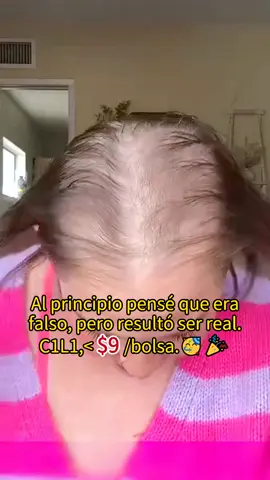 The #shampoo recommended by my doctor friend is really good. Friends with severe #hairfall must try it.#hairgrowth #antihairfall #bald#remimpi #bloomingjelly11thHBD#bloomingjellySBD#bloomingjelly#bloomingjellydressforyourself #bloomingjellyisabetterchoice