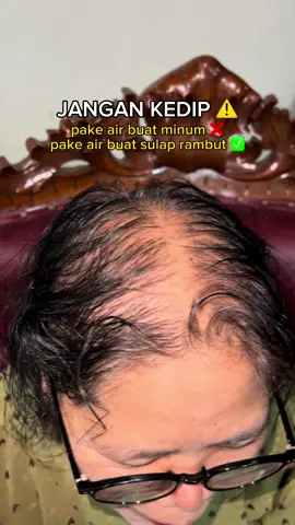 JANGAN KEDIP ⚠️ yg rambutnya tipis wajib coba sihhh gokil 👍 #serumpenumbuhrambut #penumbuhrambut #murahnikmatlezat #rambuttipis #rambutbotak #shrdhairessence 