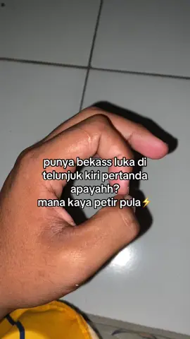 #foryou #xybca #kasusmen #unik 