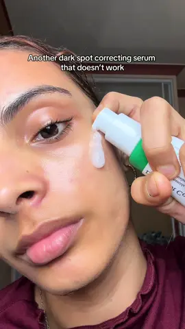Dark spot>>>niacinamide 😍 #kbeautyblogger #koreanskincareproducts  #fyp #kbeauty #skincaretips #axisy @AXIS-Y 