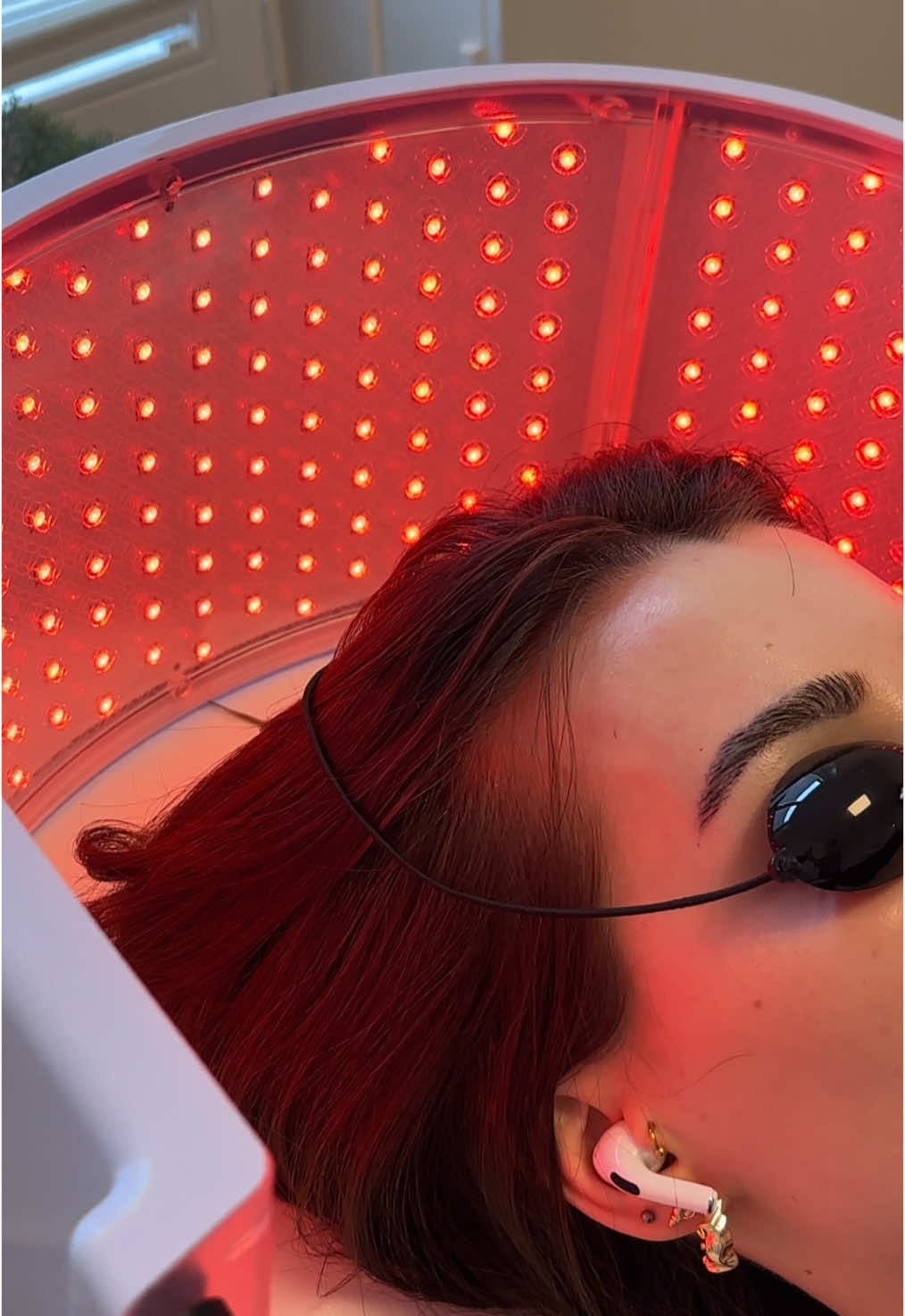 PRP ist mehr als nur eine Behandlung gegen Haarausfall - es ist eine Investition in die Vitalität deiner Haare, gesunden Kopfhaut und starke Wurzeln!  #prp #prptreatment #prpmicroneedlingfacial #prphair #zürich #basel #switzerland 