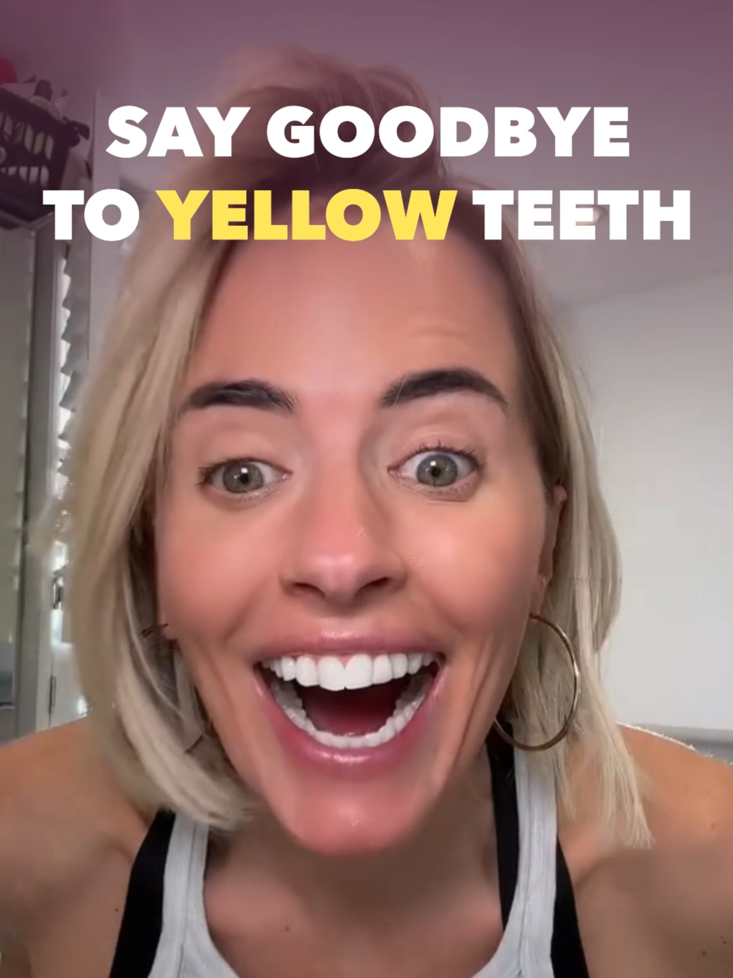 These are a MUST HAVE for WHITER TEETH! 🤩 NOW ONLY £9.99!!! #teethwhitening #whitesbeaconsfield #beauty #confidence #transformation #cosmetics