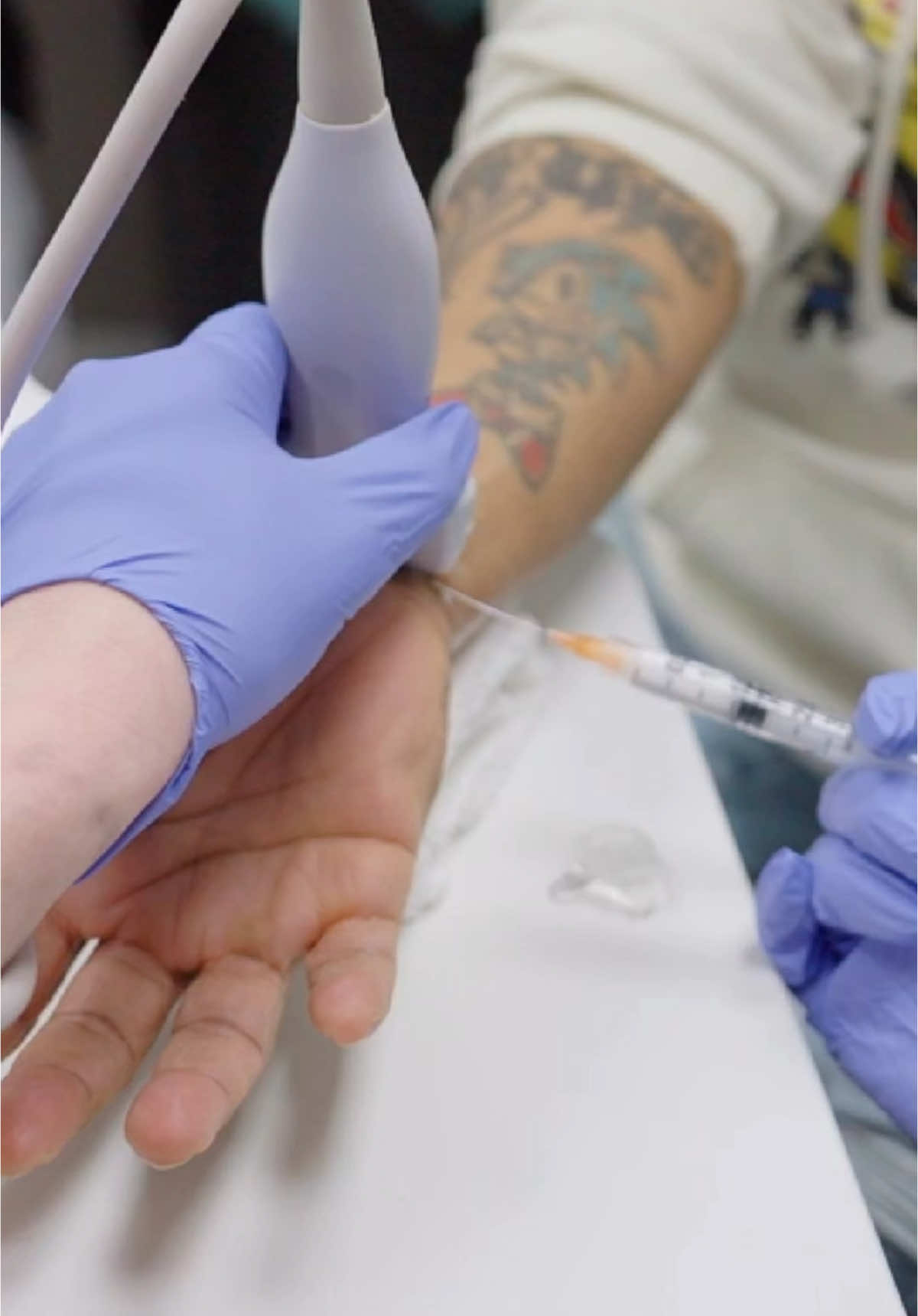How to get rid of carpal tunnel? Steroid injection for carpal tunnel can ease the pressure on your median nerve and reduce that annoying numbness and tingling in your hand. It’s quick, usually painless, and can give you serious relief—so you can use your hand without the constant discomfort. #carpaltunnel #painmanagement #painrelief #arthritis 