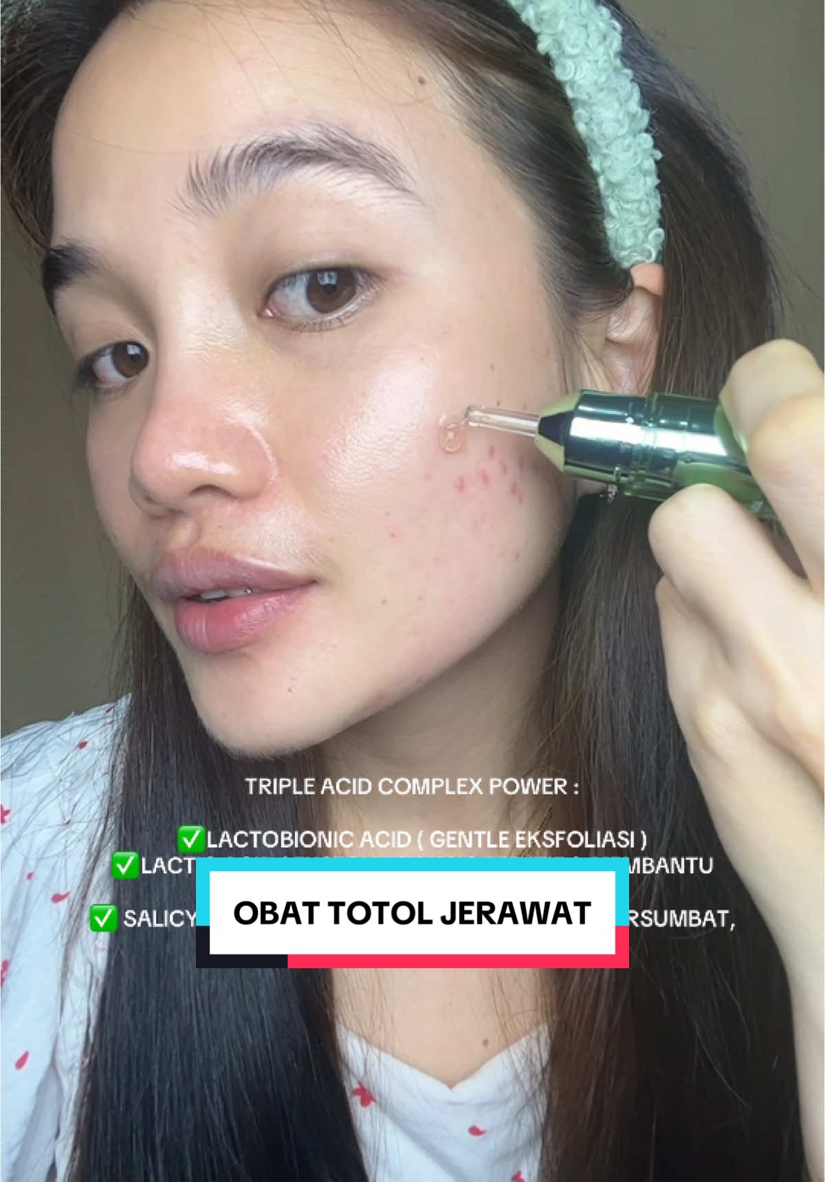 Jerawat kalian on off wajib si punya ini #skintifictotoljerawat #totoljerawatskintific #skintificacnespot #skintificacneseries #acnespot #totoljerawat 