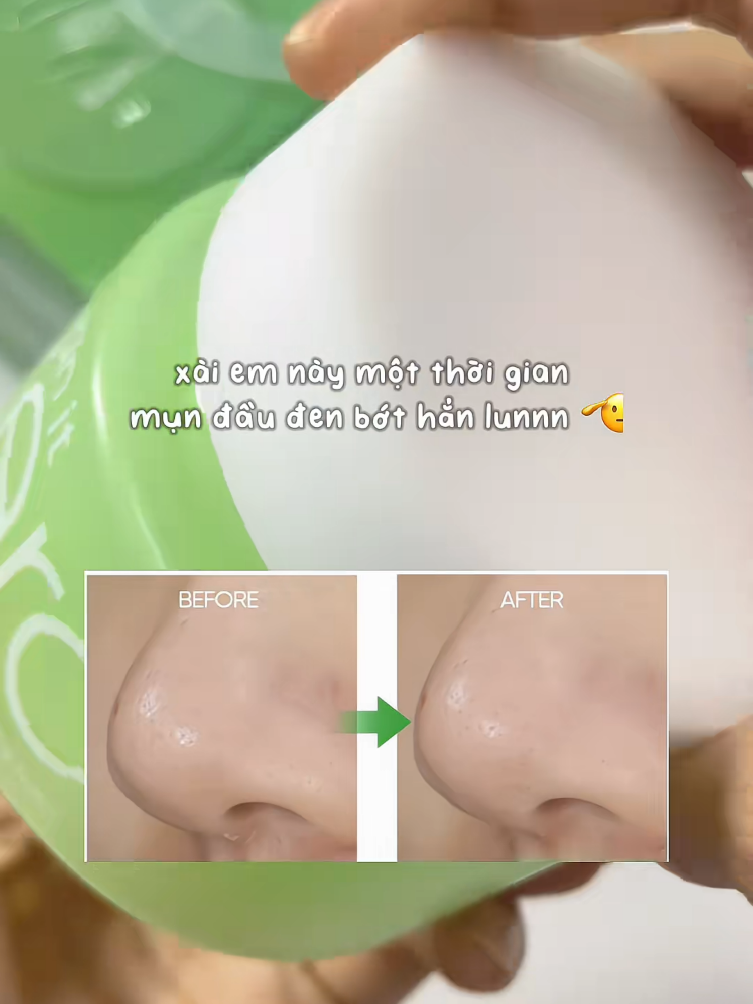 Mùa hè nắng nóng đã tới, sở hữu ngay chân ái tẩy trang cho da dầu, da mụn để có một làn da sạch sâu, khỏe mạnh #banilacovn #saptaytrangbanilaco #MustTry