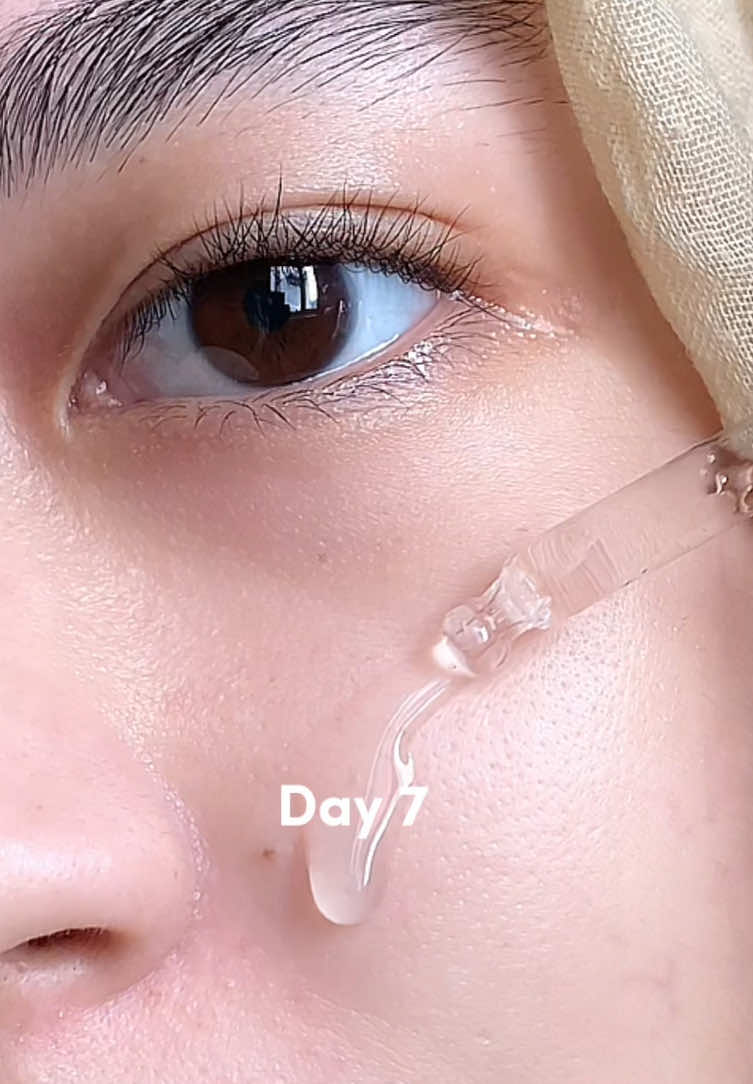 Clear your pores with the Pink Ampoule!💖✨ #Pori #Pinkampoule #Poremizingampoule #kbeauty #SKIN1004 #glowyskin #fyp #kskincare 