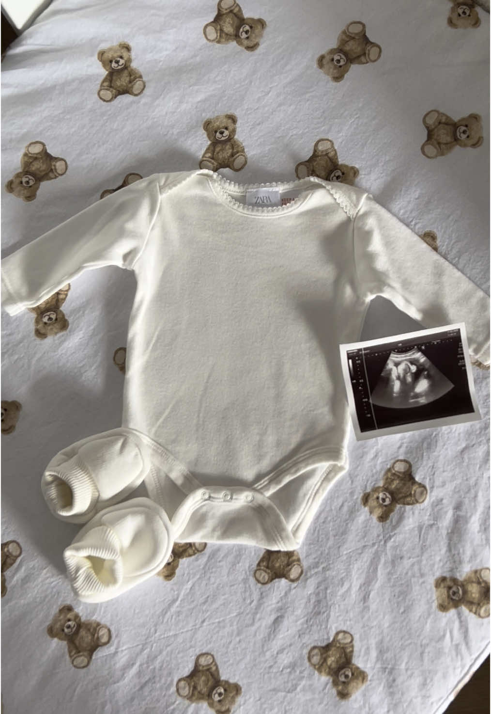 #pregnancy #pregnanttrend 