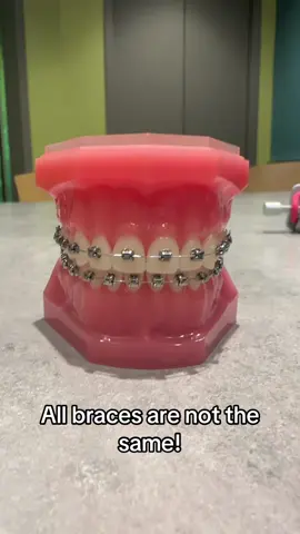 Not all braces are the same!  At Varallo Orthodontics, we use Damon braces.  They are easier to clean, require less appointments, and are more comfortable than traditional braces.  #fyp #braces #damonbraces #orthodontist #damonbraces #arlingtonma #burlingtonma #smile #