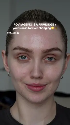 Ageing is a privilege and your skin is forever changing, remember you are beautiful✨ #makeup #filtervsreality #realskin #skintok #aging #ageing #bodypositivity #skinpositivity #skintexture #acneproneskin #acnefighter #skincare #bodyimage #loveyourskin 