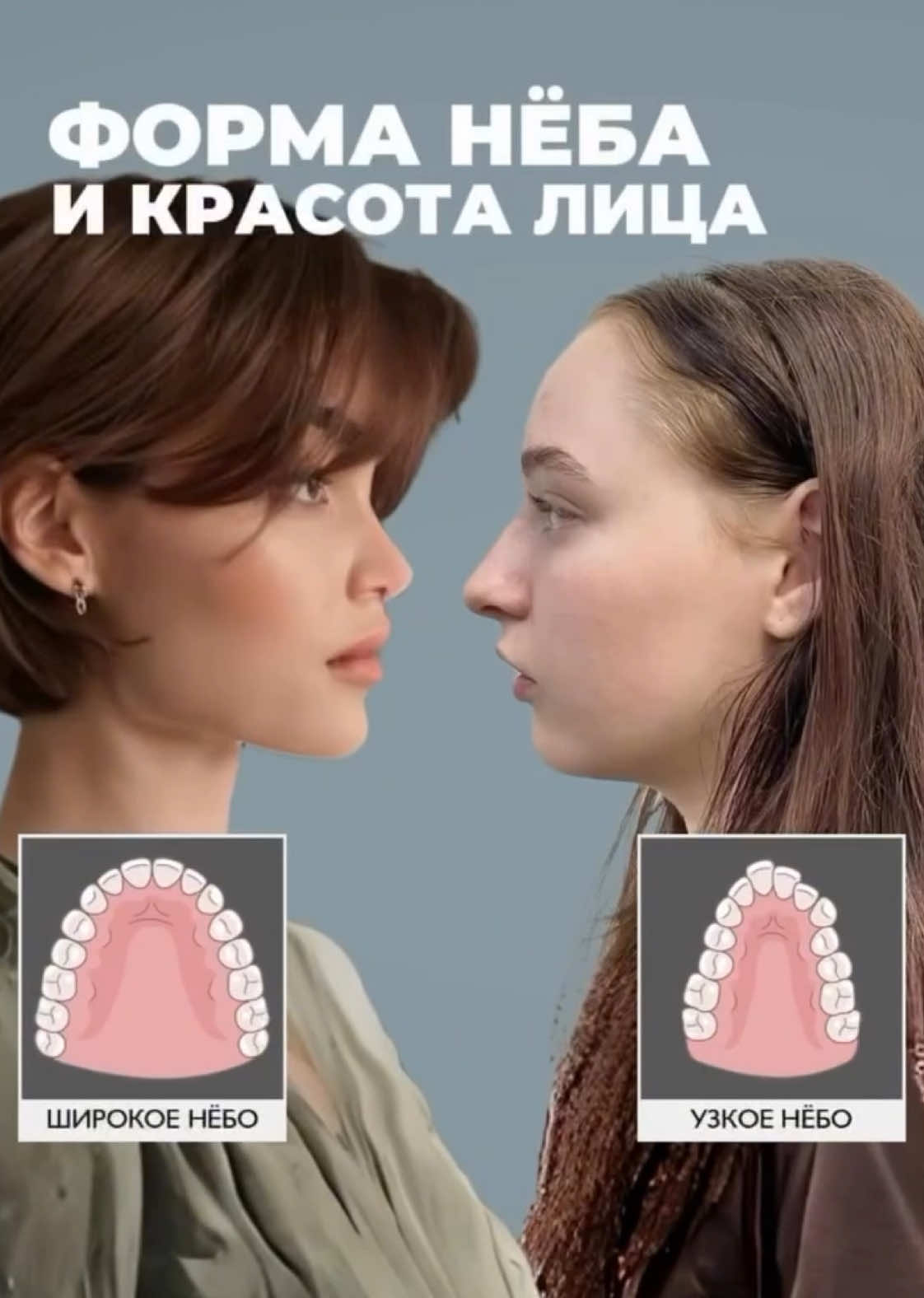 Форма и положение верхнего нёба — важный анатомический фактор, который влияет на развитие лицевого скелета, прикус и визуальное восприятие лица. В этом видео — о том, как высокое или узкое небо может изменить пропорции, симметрию и даже дыхание, и почему это важно учитывать не только в ортодонтии, но и в челюстно-лицевой хирургии. #лекарь 