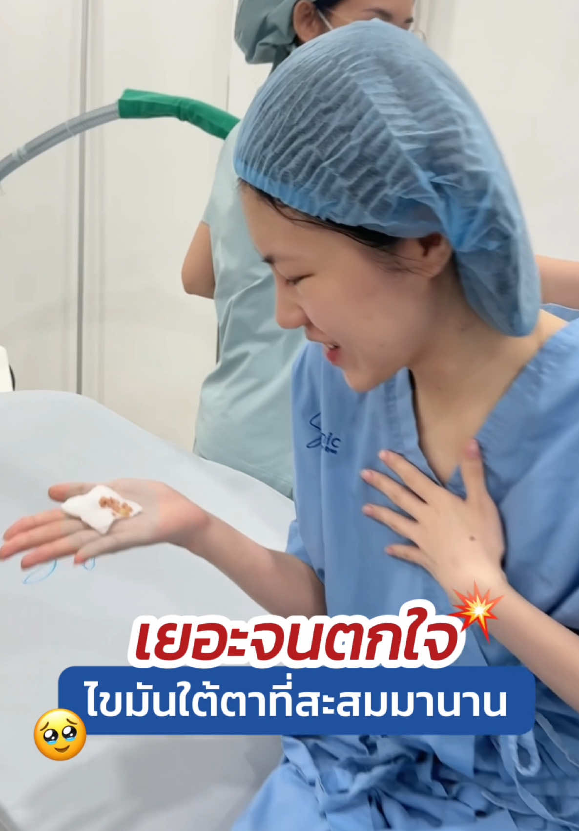เยอะจนตกใจ 💥 #ถุงใต้ตา ที่สะสมมานาน 🥺 #skyclinic #สกายคลินิก #กำจัดถุงใต้ตาแผลใน #ทำตาที่ไหนดี #ศัลยกรรมตา #babylock #ทีมแพทย์หมอสกาย #จักษุแพทย์ #หมอตา 