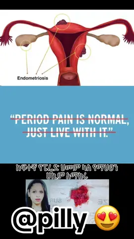 #ዶክተርሀረግ #drhareg #endometriosis #ኢንዶሜሪዮሲስ 